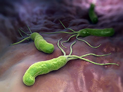 Helicobacter pylori image